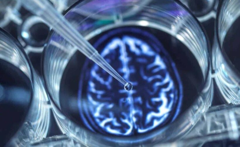 Las mujeres tienen mayor riesgo de padecer Alzheimer, según especialistas