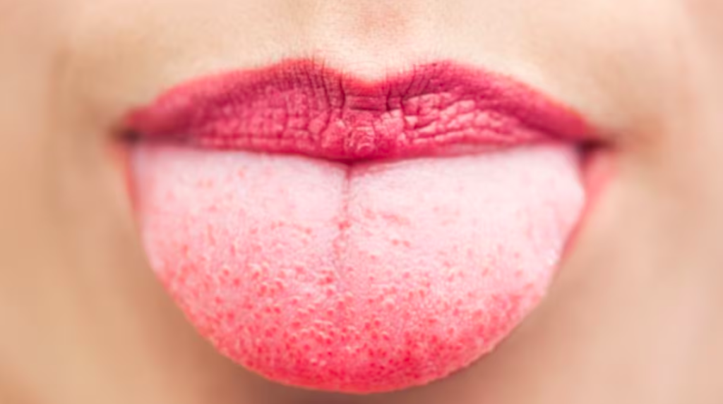 Conoce cómo la lengua puede revelar problemas de salud